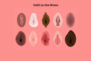 Dalili za Uke Mnato
